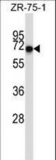 CD5 Antibody western blot of ZR-75-1 cell line lysates (35 ug/lane). The CD5 antibody detected the CD5 protein (arrow).