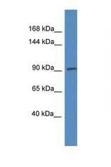 ADAMTS6 antibody LS-C145496 Western blot of 8226 Cell lysate. Antibody concentration 1 ug/ml.