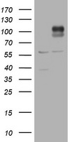 HEK293T cells were transfected with the pCMV6-ENTRY control (Left lane) or pCMV6-ENTRY ADAMTS8 (Right lane) cDNA for 48 hrs and lysed. Equivalent amounts of cell lysates (5 ug per lane) were separated by SDS-PAGE and immunoblotted with anti-ADAMTS8.