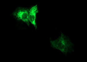 Anti-ADAMTS8 mouse monoclonal antibody immunofluorescent staining of COS7 cells transiently transfected by pCMV6-ENTRY ADAMTS8.
