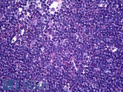 Anti-CD58 antibody IHC of human thymus. Immunohistochemistry of formalin-fixed, paraffin-embedded tissue after heat-induced antigen retrieval. Antibody LS-B5386 concentration 5 ug/ml.