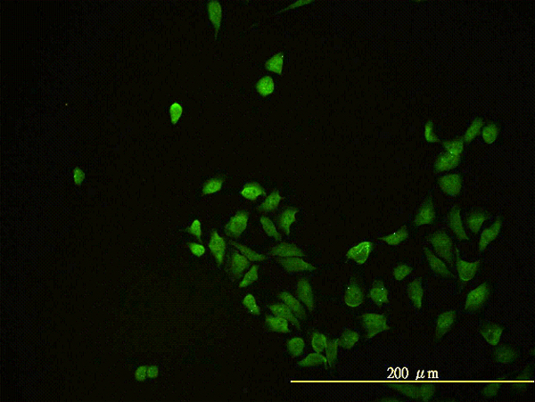 Immunofluorescence of monoclonal antibody to CD58 on HeLa cell. [antibody concentration 10 ug/ml]