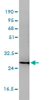 CD58 monoclonal antibody (M01), clone 2D11-B10 Western blot of CD58 expression in Jurkat.