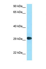 CD58 antibody LS-C146542 Western blot of COL0205 Cell lysate. Antibody concentration 1 ug/ml.