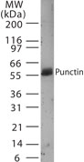 Western blot of punctin using antibody at a 1:250 dilution against human heart.
