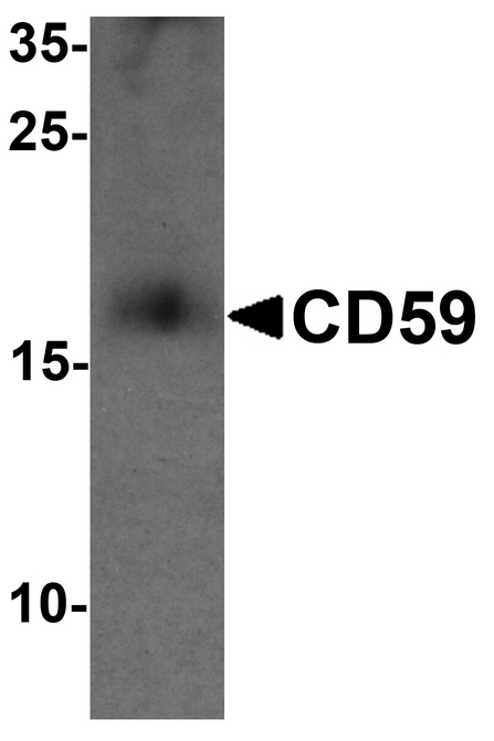 Western blot analysis of CD59 in mouse spleen tissue lysate with CD59 antibody at 1 ug/ml