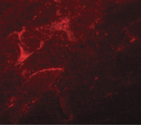 Immunofluorescence of ADAMTSL5 in mouse skeletal muscle tissue with ADAMTSL5 antibody at 20 ug/ml.