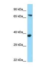 FYB antibody LS-C146173 Western blot of 293T Cell lysate. Antibody concentration 1 ug/ml.