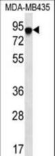 FYB Antibody western blot of MDA-MB435 cell line lysates (35 ug/lane). The FYB antibody detected the FYB protein (arrow).