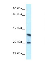 CD63 antibody LS-C145649 Western blot of 3 Cell lysate. Antibody concentration 1 ug/ml.