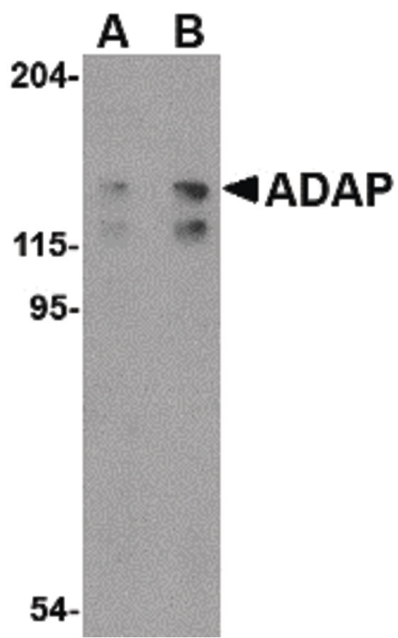 Western blot of ADAP in K562 cell lysate with ADAP antibody at (A) 0.5 and (B) 1 ug/ml.
