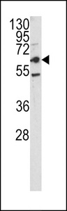 Western blot of CEACAM antibody in HepG2 cell line lysates (35 ug/lane). CEACAM (arrow) was detected using the purified antibody.