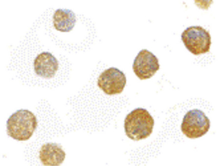 Immunocytochemistry of ADAP in K562 cells with ADAP antibody at 10 ug/ml.