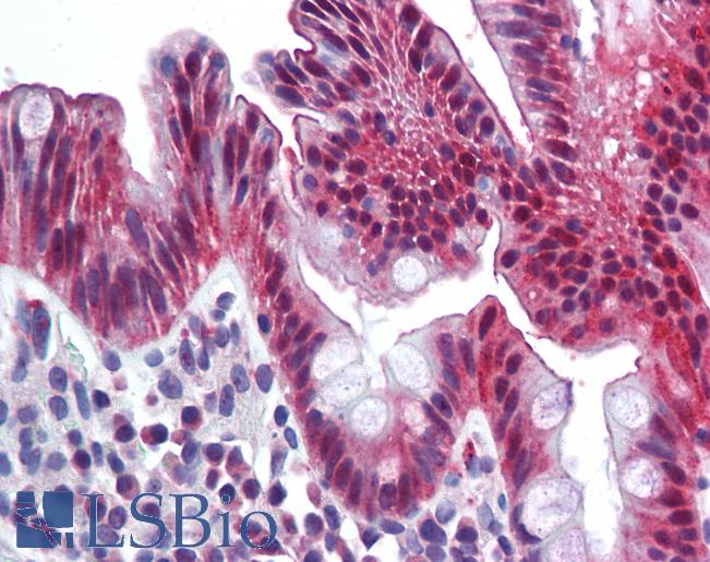 Anti-CEACAM1 antibody LS-A9698 IHC of human colon. Immunohistochemistry of formalin-fixed, paraffin-embedded tissue after heat-induced antigen retrieval.