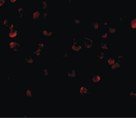 Immunofluorescence of ADAP in K562 cells with ADAP antibody at 20 ug/ml.