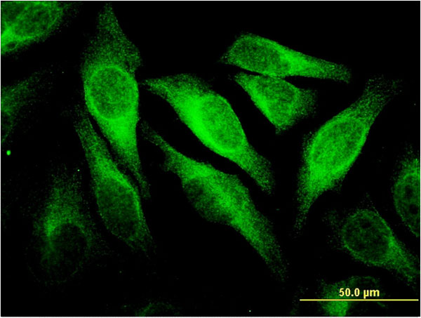 Immunofluorescence of monoclonal antibody to CEACAM6 on HeLa cell . [antibody concentration 10 ug/ml]