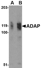 Western blot of ADAP in K562 cell lysate with ADAP antibody at (A) 0.5 and (B) 1 ug/ml.