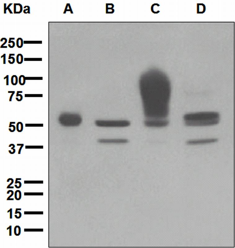 Western blot analysis on (A) human placenta, (B) JAR, (C) HT-29, and (D) MCF-7 cell lysates using anti-CEACAM6 antibody.