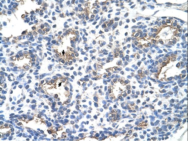 CEACAM6 antibody LS-C31874 was used in IHC to stain formalin-fixed, paraffin-embedded human lung.