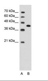 A: Marker, B: Jurkat Cell Lysate