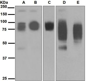 Western blot analysis on (A) MCF-7, (B) SW480, (C) HT-29, (D) A549, and (E) BxPC-3 cell lysates using anti-CEACAM6 antibody.