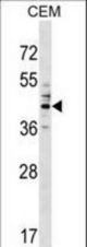 CEACAM6 Antibody western blot of CEM cell line lysates (35 ug/lane). The CEACAM6 antibody detected the CEACAM6 protein (arrow).