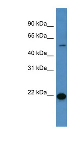 CEACAM3 antibody LS-C135716 Western blot of Fetal Liver lysate.