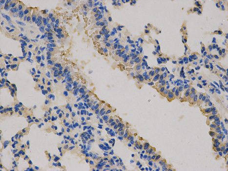 Immunohistochemistry of paraffin-embedded human lung using CEACAM3 antibody at dilution of 1:100 (400x lens).