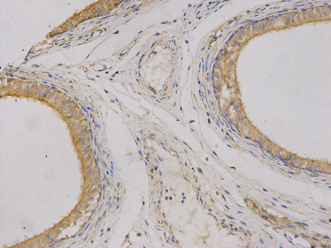 Immunohistochemistry of paraffin-embedded human epididymis using CEACAM3 antibody at dilution of 1:100 (200x lens).