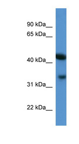 ADAP1 / CENTA1 antibody LS-C135273 Western blot of Mouse Kidney lysate.