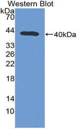 Western blot of recombinant ADAP1 / CENTA1.
