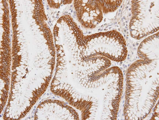 IHC of paraffin-embedded gastric tissue using Centaurin alpha 1 antibody at 1:100 dilution.