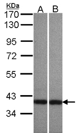 Sample (30 ug of whole cell lysate). A: A431 , B: HeLaS3. 7.5% SDS PAGE. CENTA1 / ADAP1 antibody diluted at 1:500