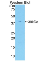 Western blot of recombinant ADAP2 / CENTA2.