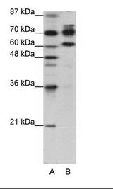 A: Marker, B: HepG2 Cell Lysate