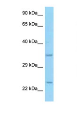 CD69 antibody LS-C146307 Western blot of HCT15 Cell lysate. Antibody concentration 1 ug/ml.