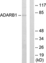Western blot of extracts from HepG2 cells, using ADARB1 Antibody. The lane on the right is treated with the synthesized peptide.