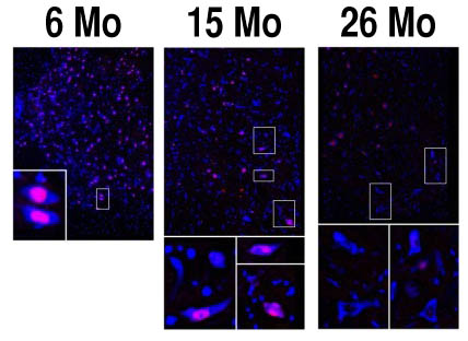 Immunofluorescence staining of mouse anterior horns of spinal cord at 6 months, 15 months and 26 months of age. Antibody used at 1:100 dilution and visualized using donkey anti-sheep conjugated to Alexa 555 dye (red color). The blue color is a fluorescent nuclear probe, TOPRO3. (Image modified from original in citation 1)