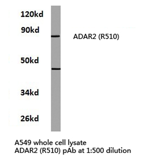 Western blot of ADAR2 (R510) pAb in extracts from A549 cells.
