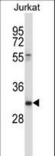 CD7 Antibody western blot of Jurkat cell line lysates (35 ug/lane). The CD7 antibody detected the CD7 protein (arrow).