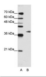 A: Marker, B: Jurkat Cell Lysate