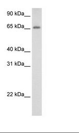 Fetal Thymus Lysate