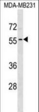 ADAT1 Antibody western blot of MDA-MB231 cell line lysates (35 ug/lane). The ADAT1 antibody detected the ADAT1 protein (arrow).