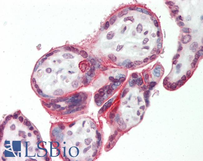 Human Placenta: Formalin-Fixed, Paraffin-Embedded (FFPE)