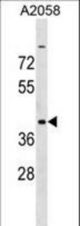 ADAT3 Antibody western blot of A2058 cell line lysates (35 ug/lane). The ADAT3 antibody detected the ADAT3 protein (arrow).