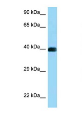 CD72 antibody LS-C146184 Western blot of Jurkat Cell lysate. Antibody concentration 1 ug/ml.