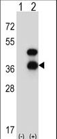 Western blot of CD72 (arrow) using rabbit polyclonal CD72 Antibody. 293 cell lysates (2 ug/lane) either nontransfected (Lane 1) or transiently transfected (Lane 2) with the CD72 gene.