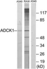 Western blot of extracts from A549/RAW264.7 cells, using ADCK1 Antibody. The lane on the right is treated with the synthesized peptide.