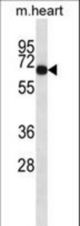 Mouse Adck1 Antibody western blot of mouse heart tissue lysates (35 ug/lane). The Adck1 antibody detected the Adck1 protein (arrow).