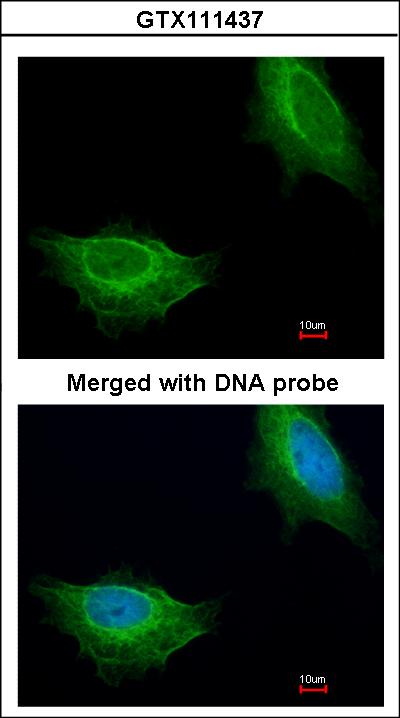 Immunofluorescence of paraformaldehyde-fixed HeLa using ADCK1 antibody at 1:200 dilution.